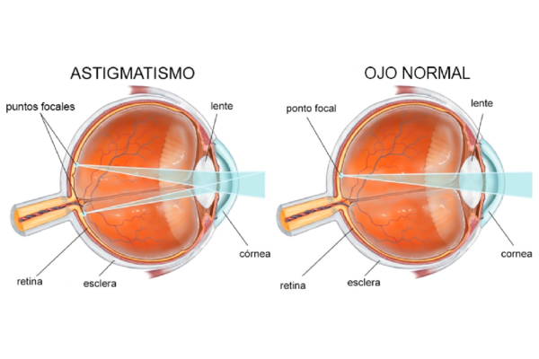 astigmati-1400x946